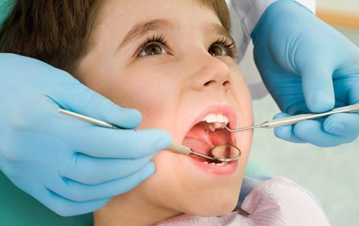 عصب‌ کشی دندان کودکان1 - نحوه نگه داری دندان شیری