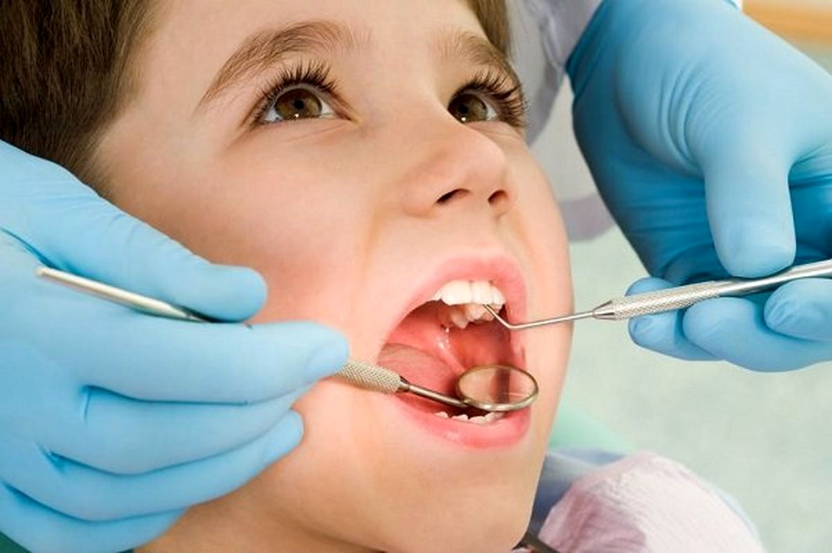 درمان پوسیدگی دندان در کودکان